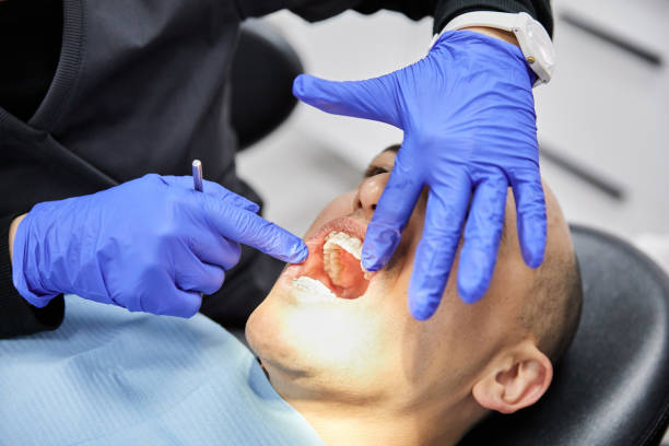 Best Emergency Broken Tooth Repair in Ogden Dunes, IN